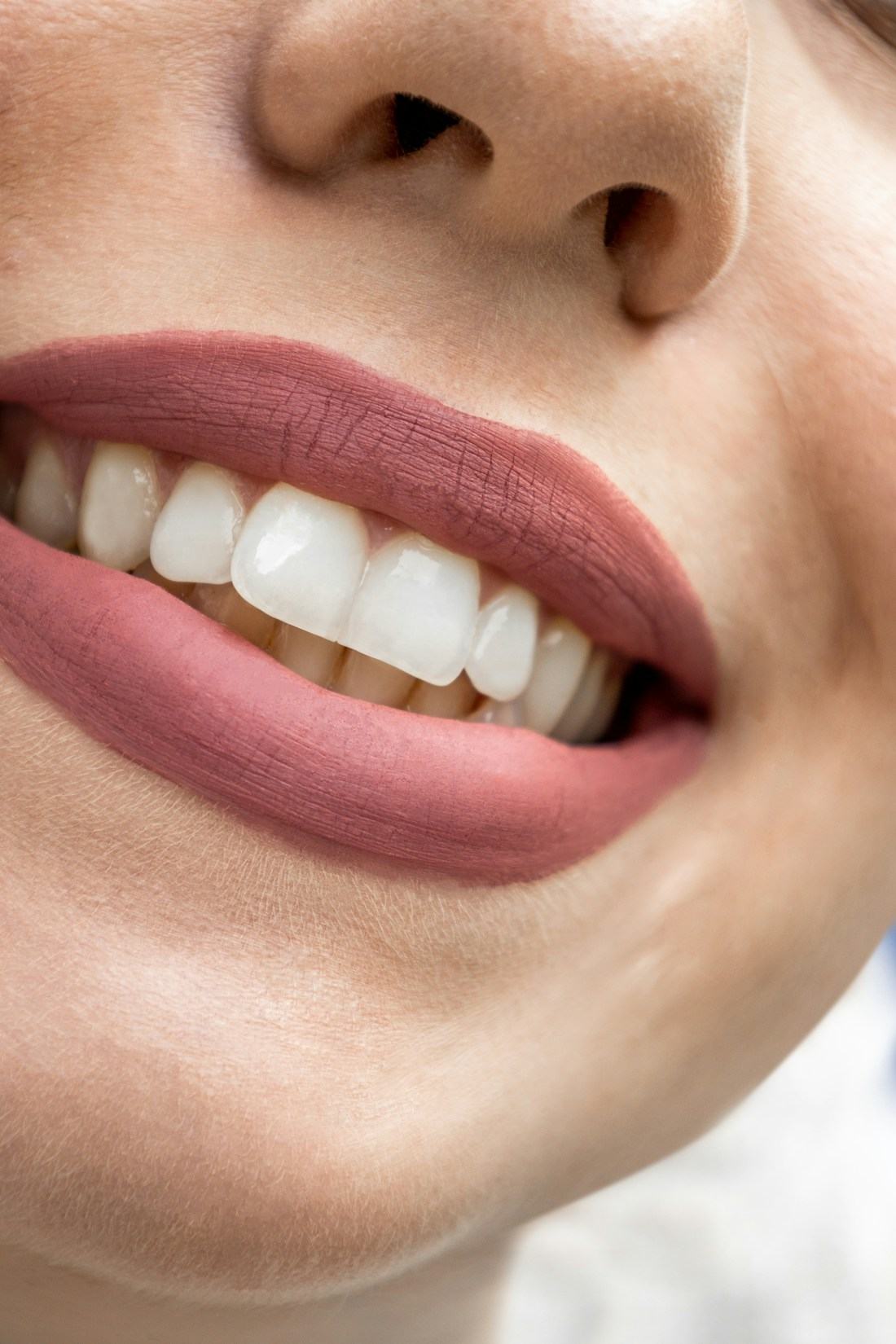Sonrisa con dientes y encías sanas en primer plano
