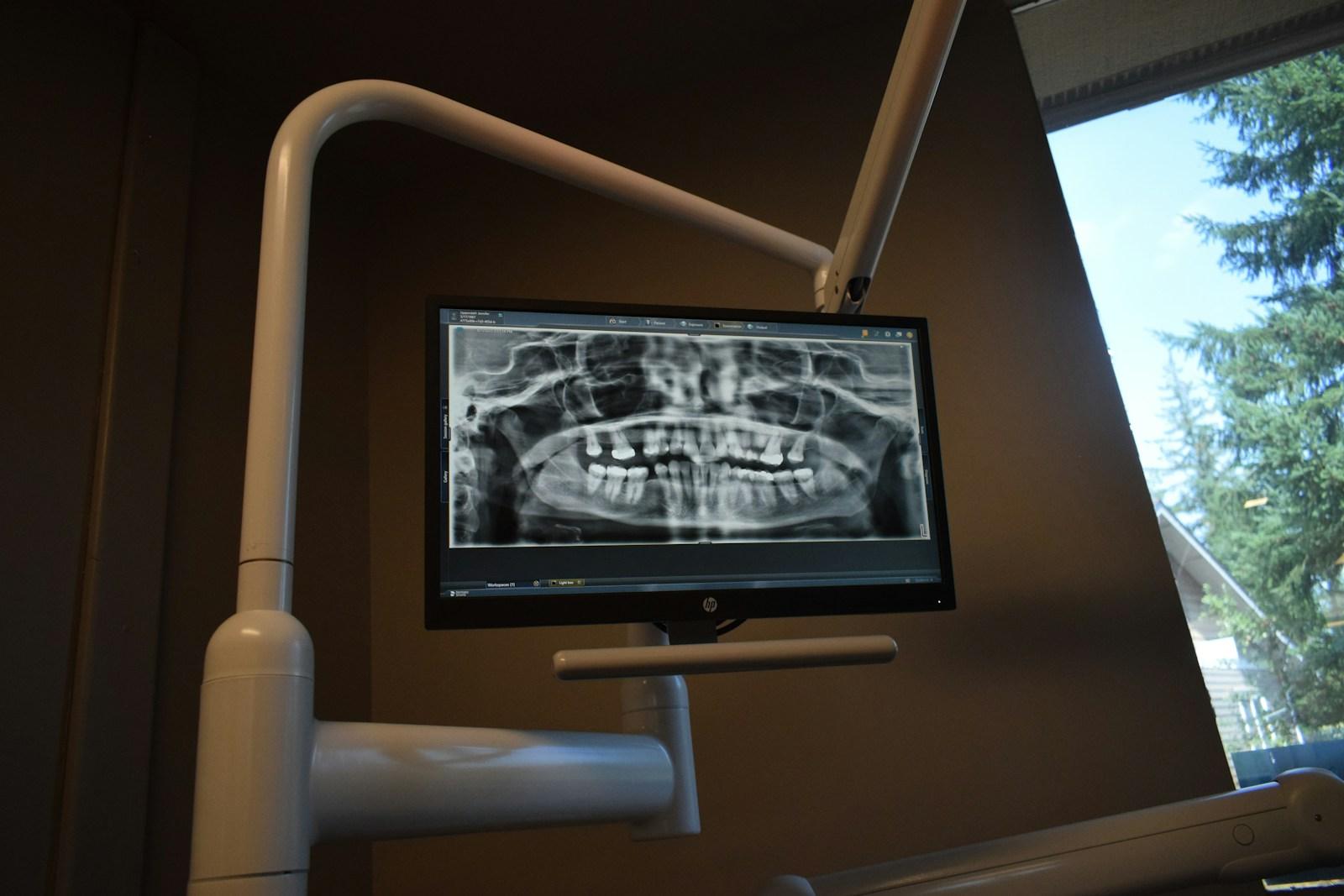 Radiografía panorámica en el monitor de un consultorio