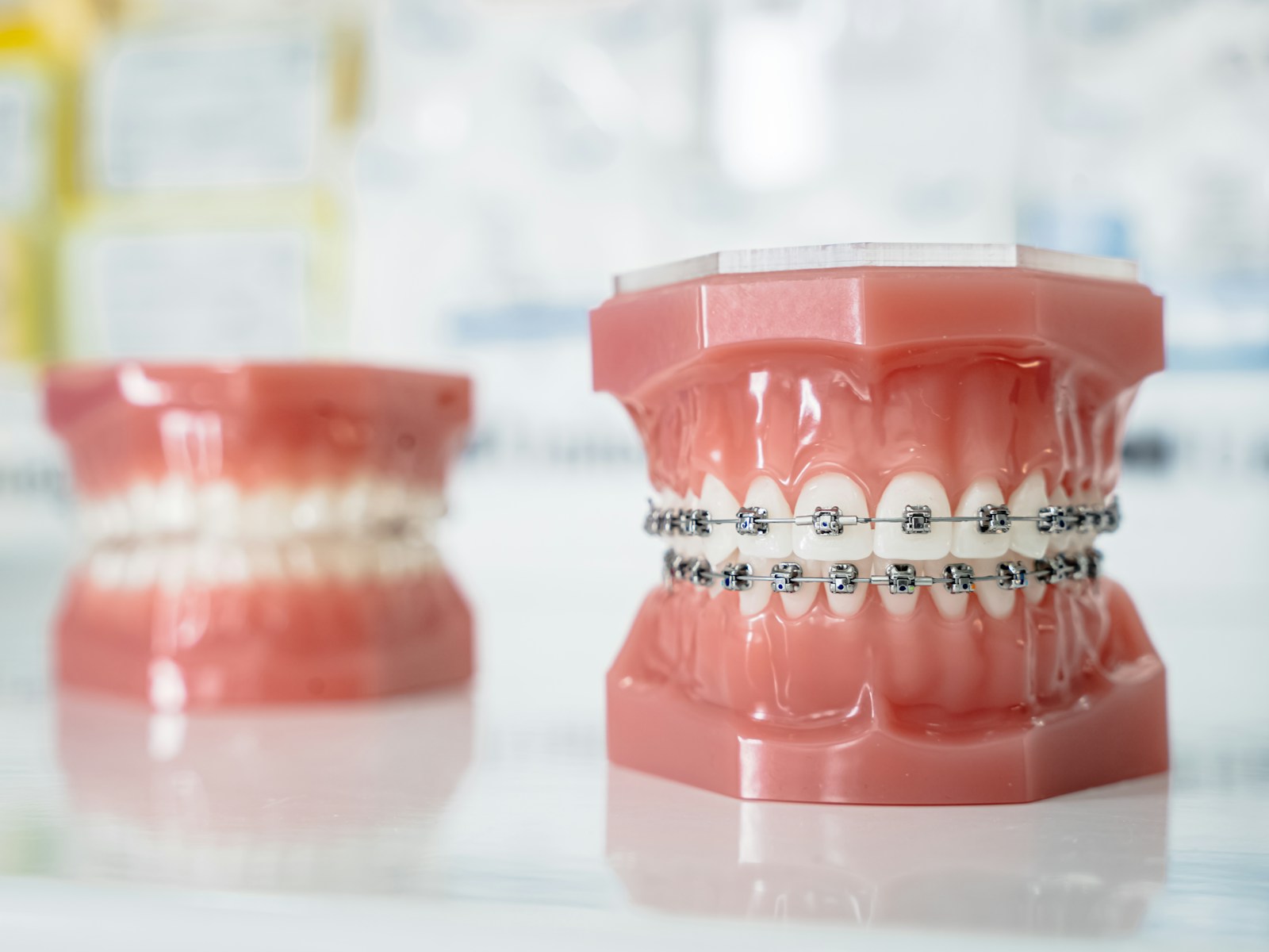 Modelo de dientes con brackets junto a un modelo sin tratamiento