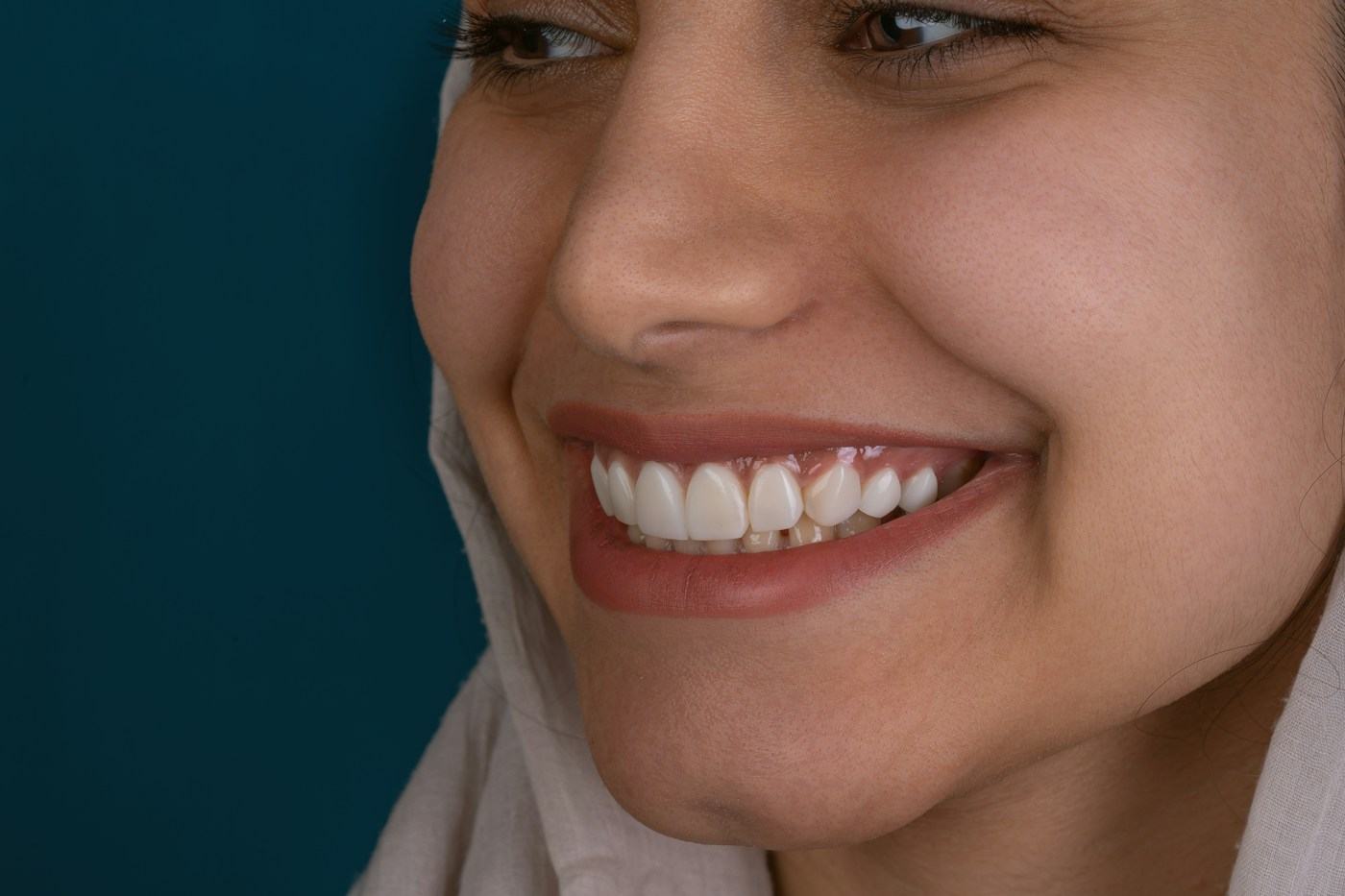 Primer plano de una mujer sonriendo con dientes parejos y blancos