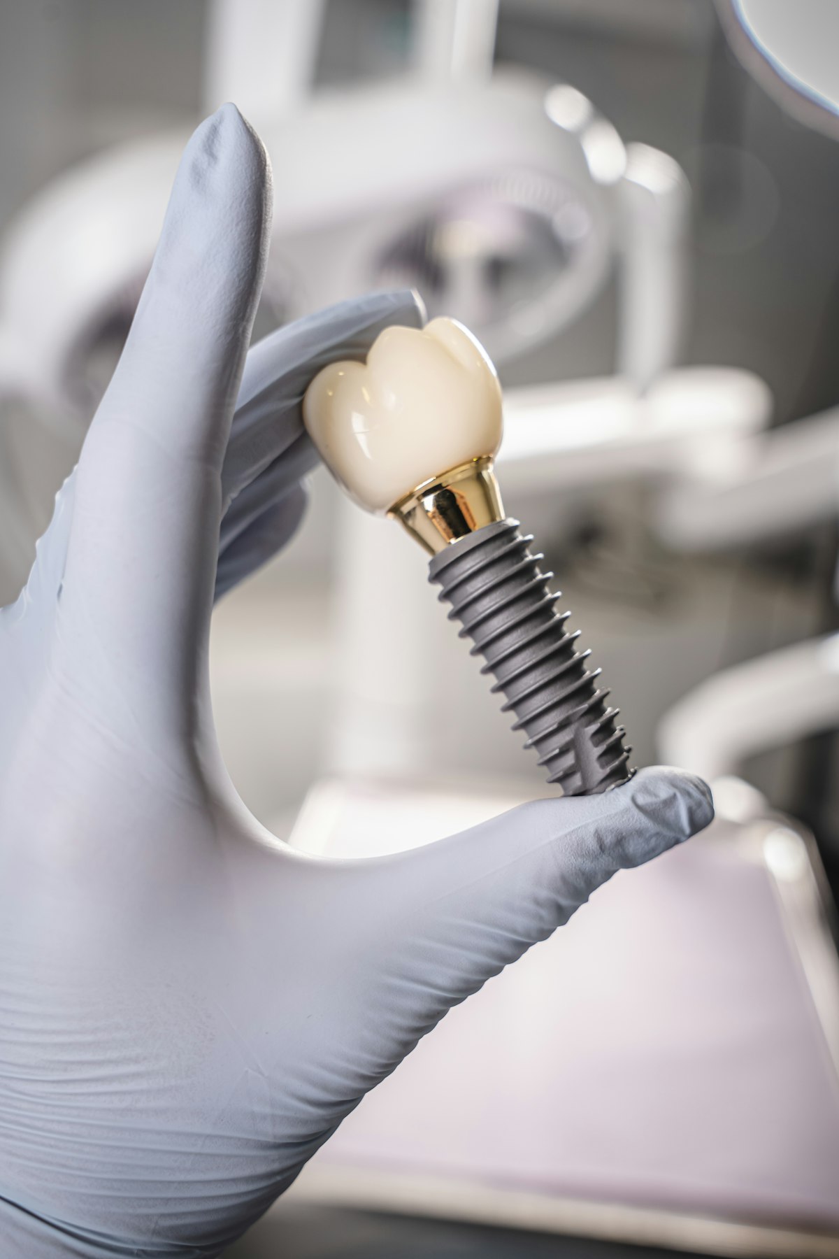 Mano con guante sosteniendo un implante dental con su corona